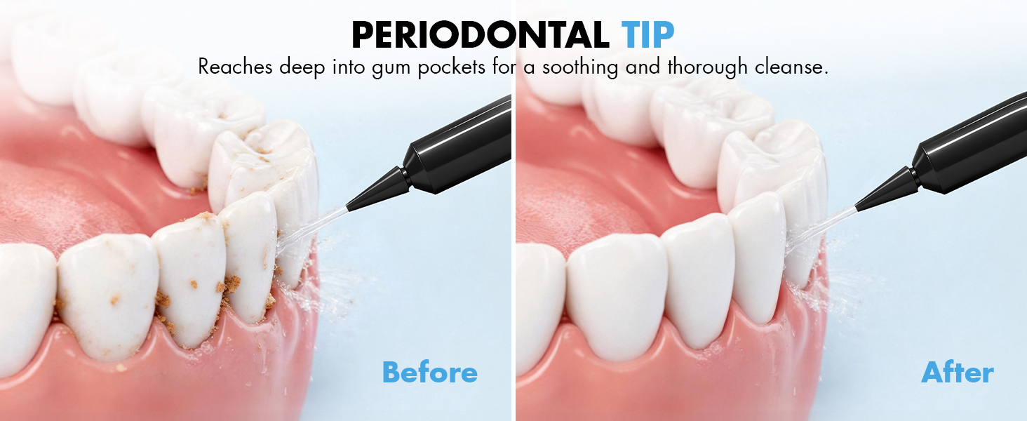 water picks for teeth cleaning and flossing