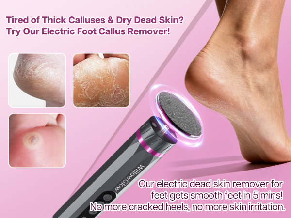 Get smooth feet in 5 minutes with an electric callus remover, ending thick calluses
