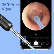 ear wax removal tool camera ear camera earwax cleaner cleaning Otoscope Ear Scoop Earwax removal kit