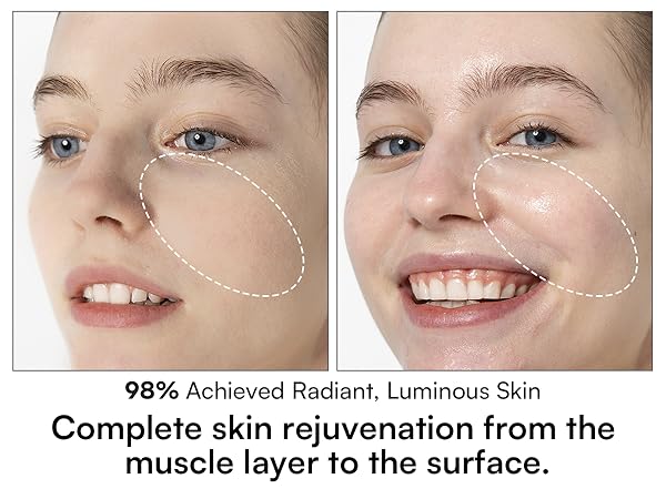 Red Light Therapy for Face