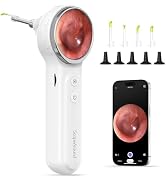 ScopeAround Otoscope with Light, Digital Otoscope w/1.85in IPS Screen, 720p HD Ear Wax Removal To...