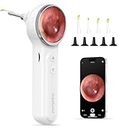 ScopeAround Otoscope with Light, Digital Otoscope w/1.85in IPS Screen, 720p HD Ear Wax Removal To...