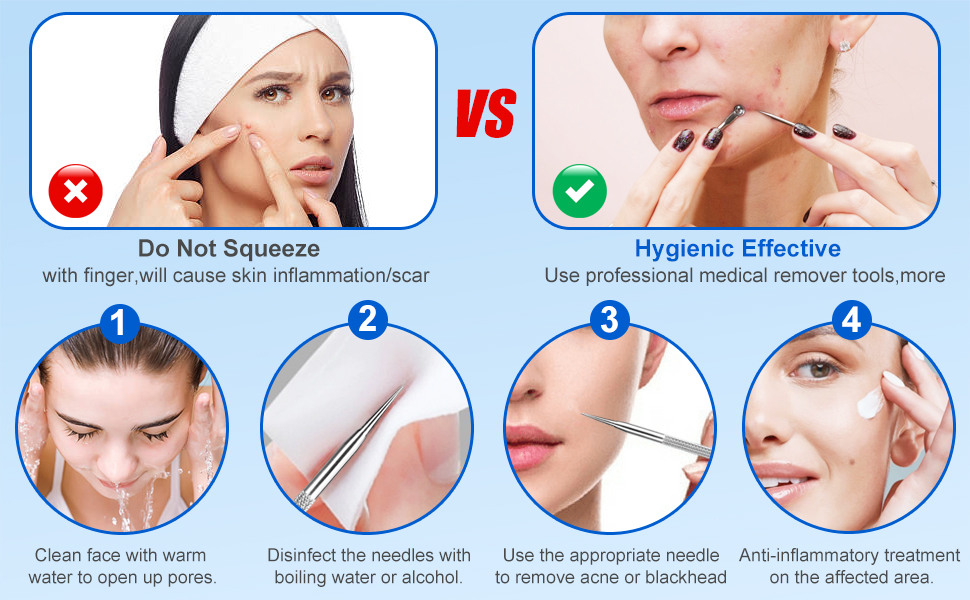 acne removal tool kit