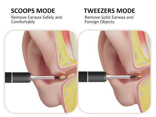 Ear Wax Removal Tool