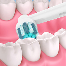 Medical illustration showing white dental crowns or implants in a row with light blue accents, demonstrating dental restoration options.