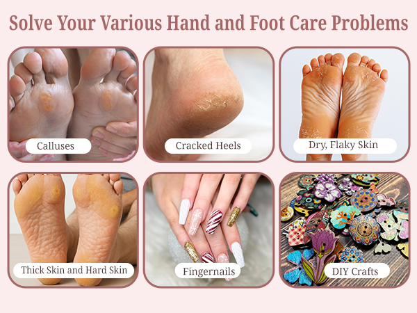 Electric Foot Callus Remover