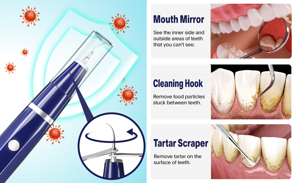 tartar remover