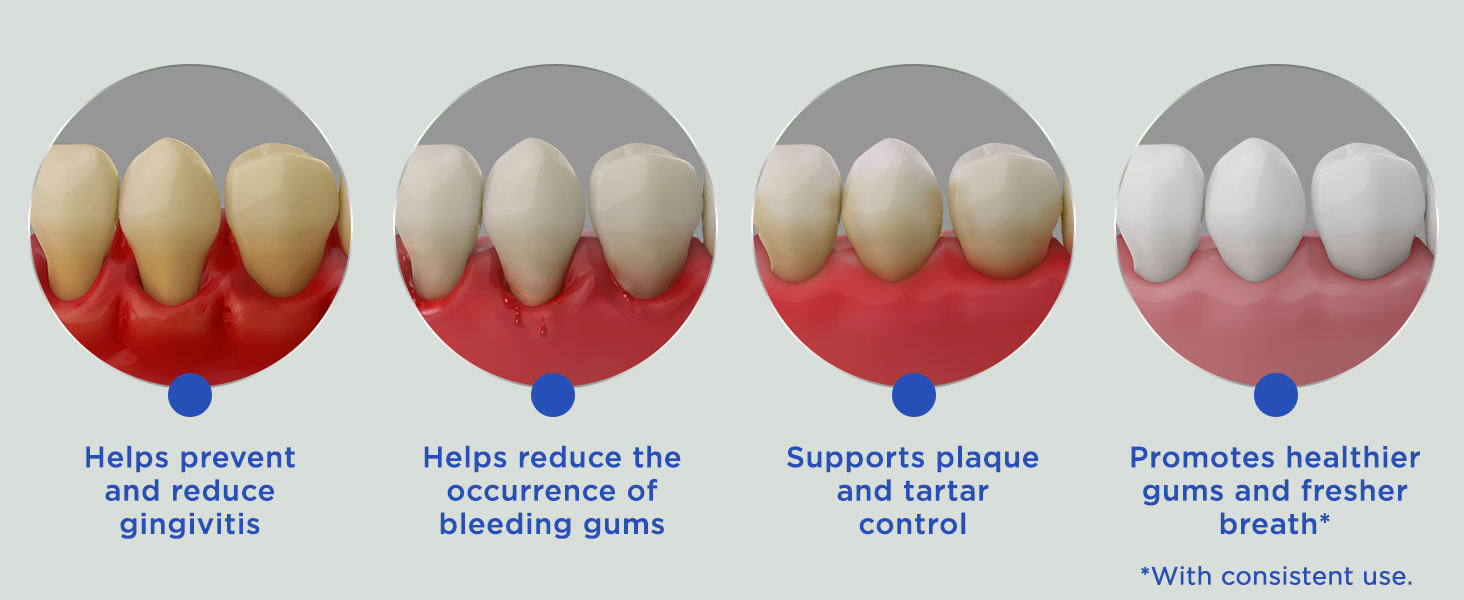 Anti-Gingivitis MW