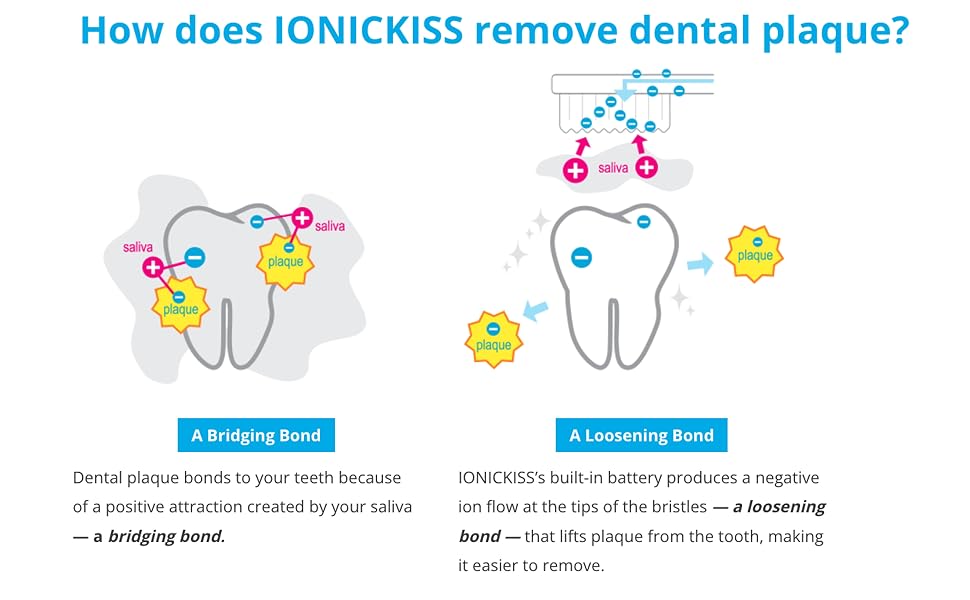 How does IONICKISS remove dental plaque?