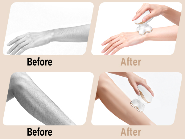 womens electric shaver