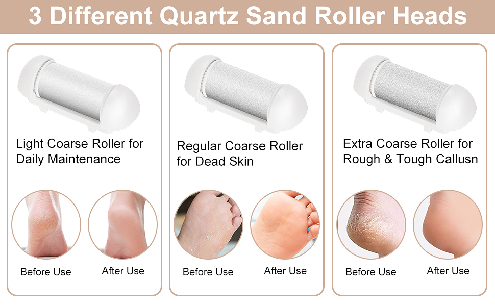Electric Foot Callus Remover