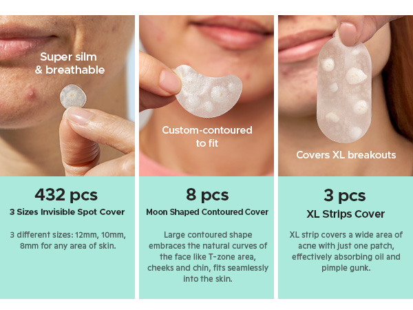 3 Shapes for More Acne Coverage