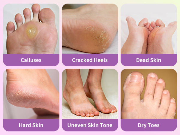 foot mask for dry cracked feet