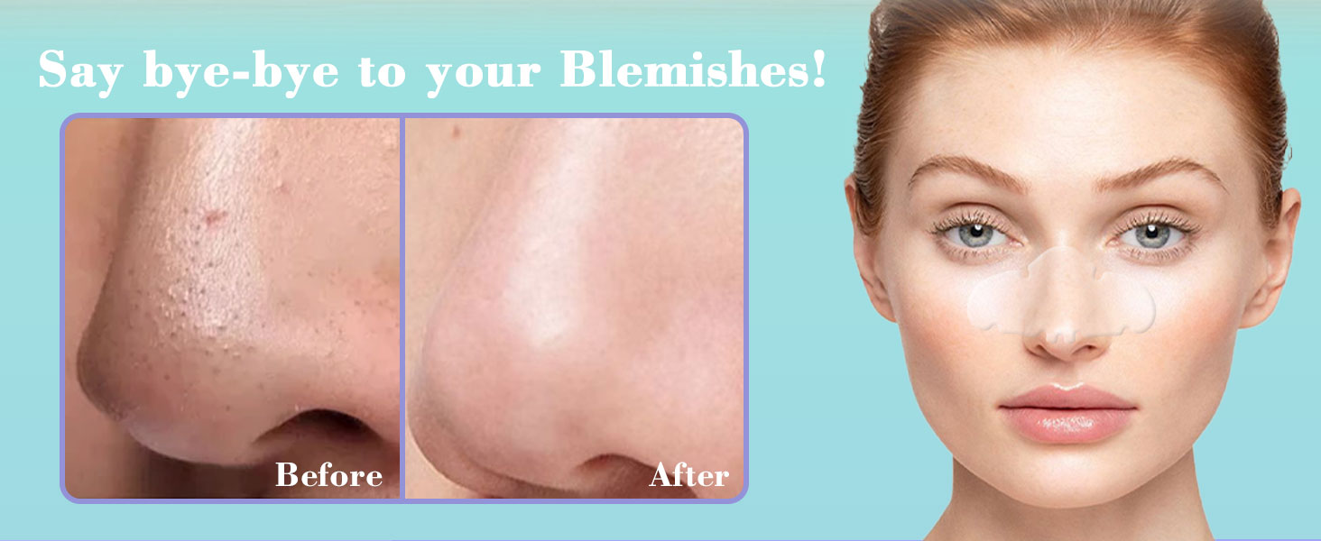 Nose Pore Patches