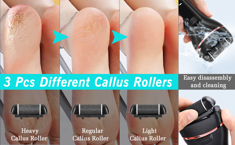 pedicure foot spa
