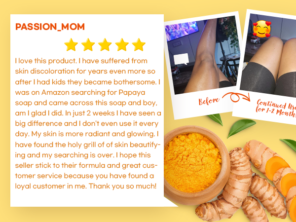 kojic acid soap