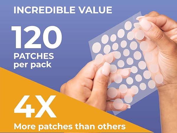 pimple patch, pimple patches, acne patches, pimple patches for face, acne treatment, acne