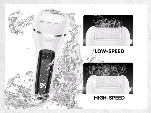 Two gears and three roughness levels
