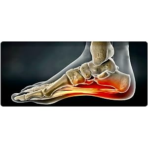 Achilles Tendonitis, Shin Splints, Achilles Tendon Injuries Squat Wedge,Fascia Stretcher,Calf