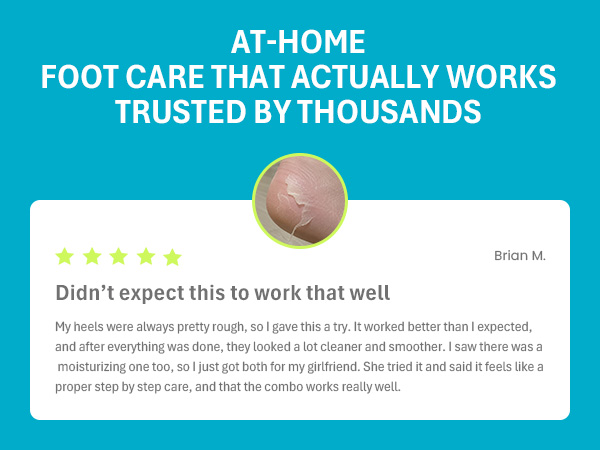 Close-up of peeling heel skin; 5-star review from Brian M. on effective foot peel mask results.