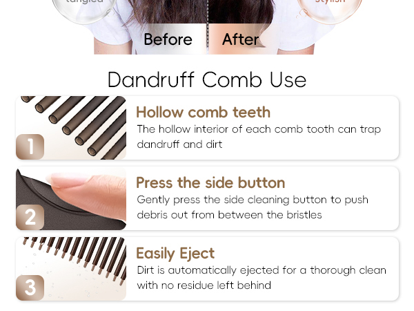 dandruff comb