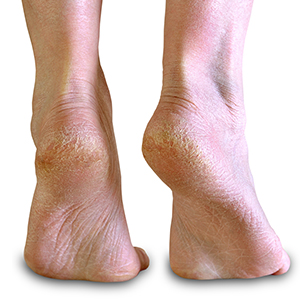 shower foot scrubber mat,foot scrubbers for use in shower,foot cleaner,shower foot scrubber