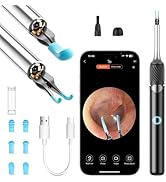 Ear Wax Removal, Ear Camera with Omnidirectional Tweezers, Otoscope with 1080P Camera, Ear Wax Re...