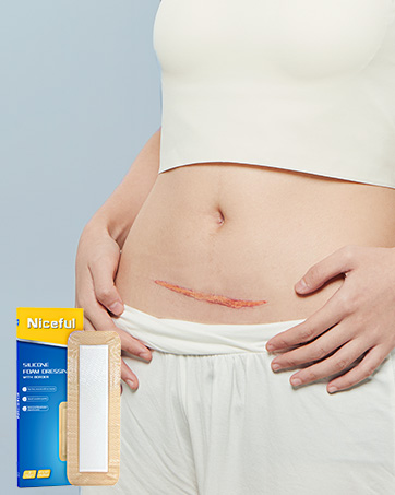 long incisions after knee replacement surgery