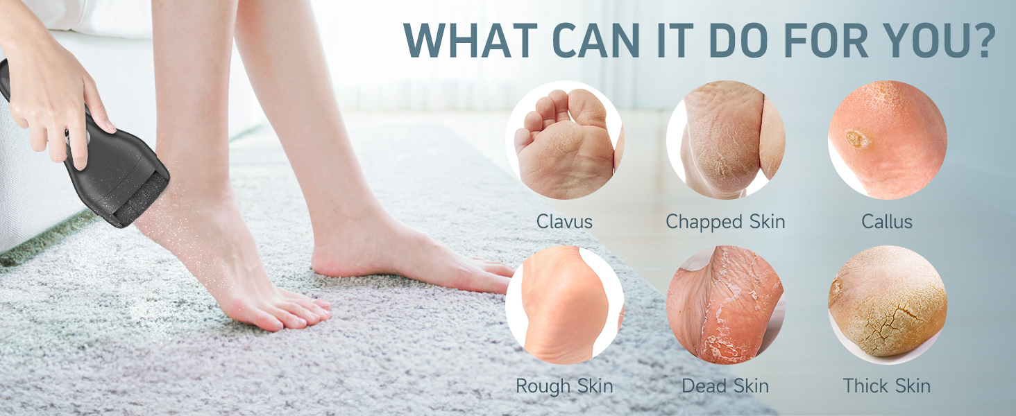 What can it do for you