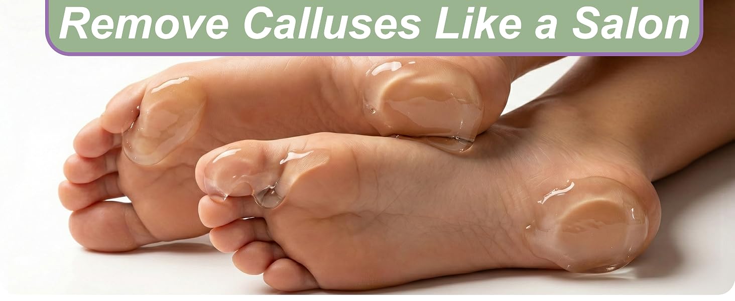 callus remover kit