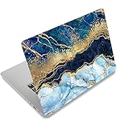 ArtSo Laptop Skin Sticker Decal, 12" 13" 13.3" 14" 15" 15.4" 15.6 inch Laptop Universal Netbook P...