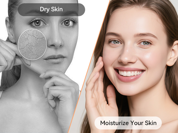 Moisturize Your Skin