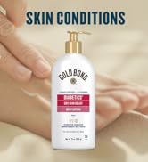 diabetic foot cream