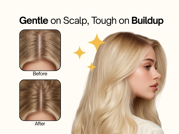 Revive on dandruff control