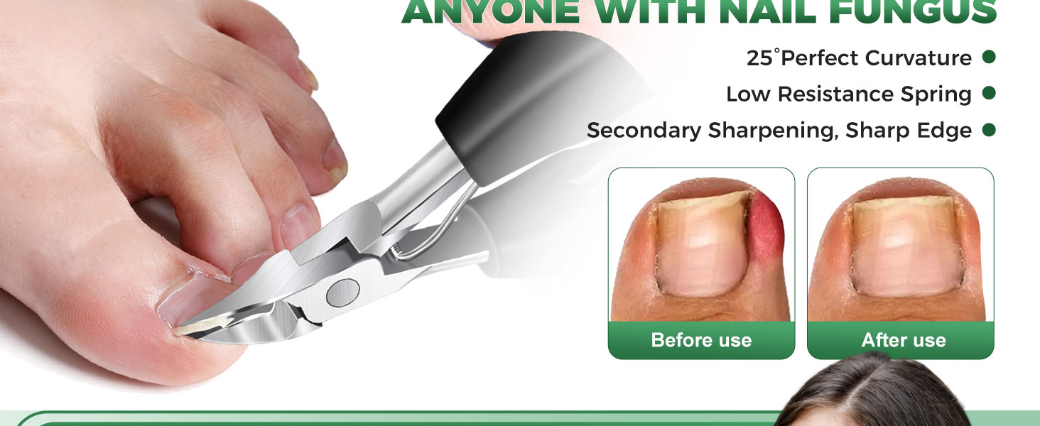Toenail Clippers for Seniors Thick Toenails