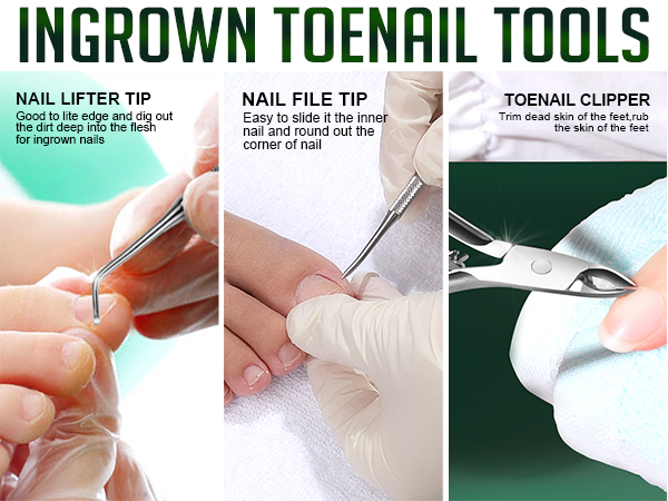 Ingrown Toenail Lifter