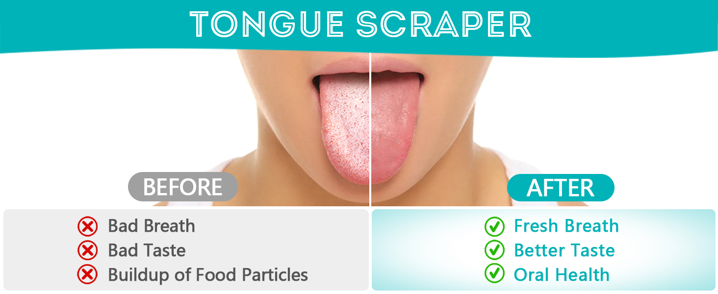 tongue scrappers 2 Pack Tongue Scraper