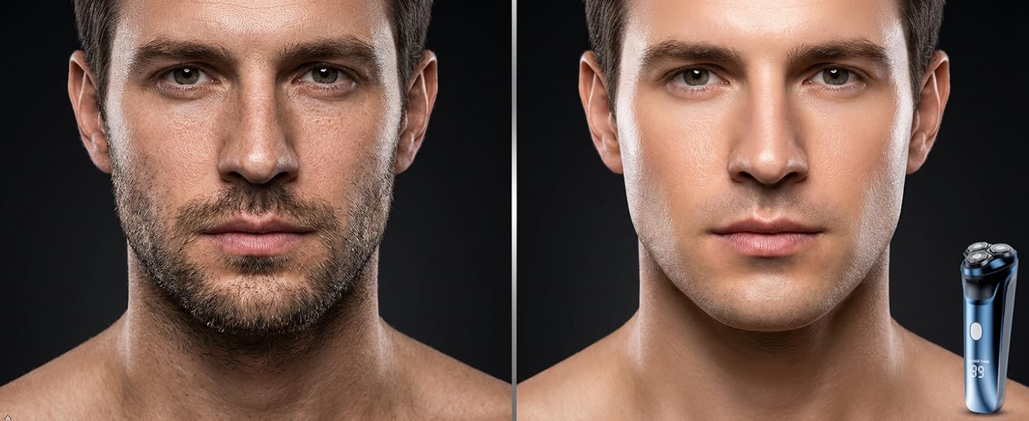 Before and After