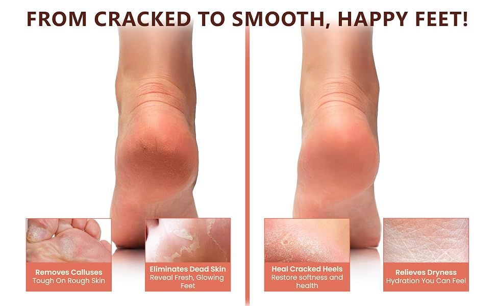 Natural pumice stone for feet, foot scrubber, callus remover, and exfoliator for smooth, happy feet