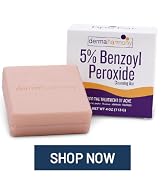 Dermaharmony 5% Benzoyl Peroxide Cleansing Bar for acne (4 oz)