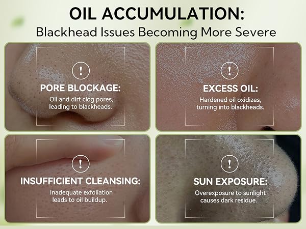 oil accumulation