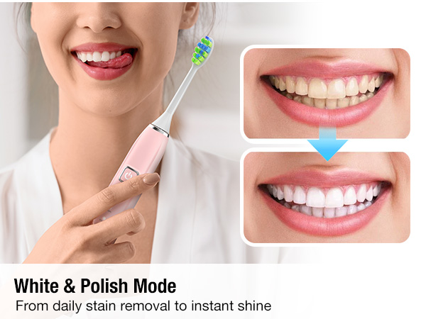 electric toothbrush