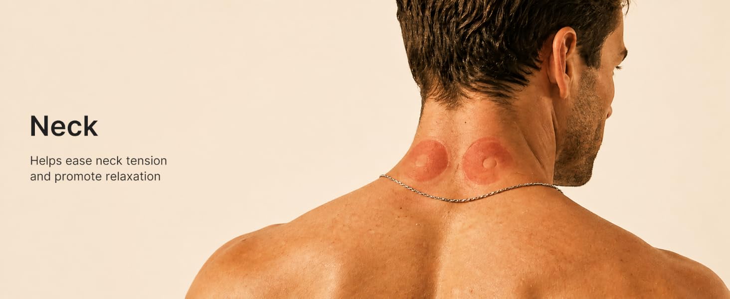 cupping set