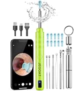 Ear Wax Removal, Ear Cleaner with Camera, Ear Cleaning Kit 1296P HD Ear Scope, 6 LED Lights and 1...