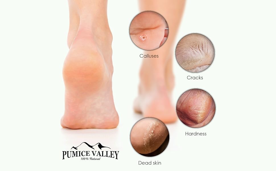 foot problems 2