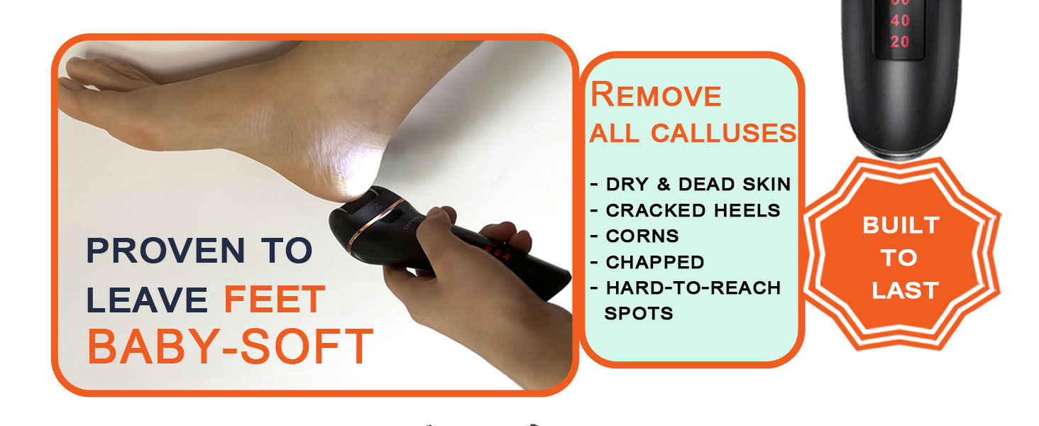 feet callus remover