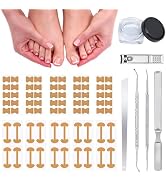Ingrown Toenail Removal Kit,Professional Toenail Tool Kit Includes Breathable Toenail Strips, Cur...