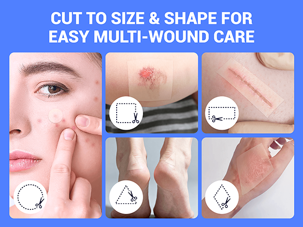 hydrocolloid bandage