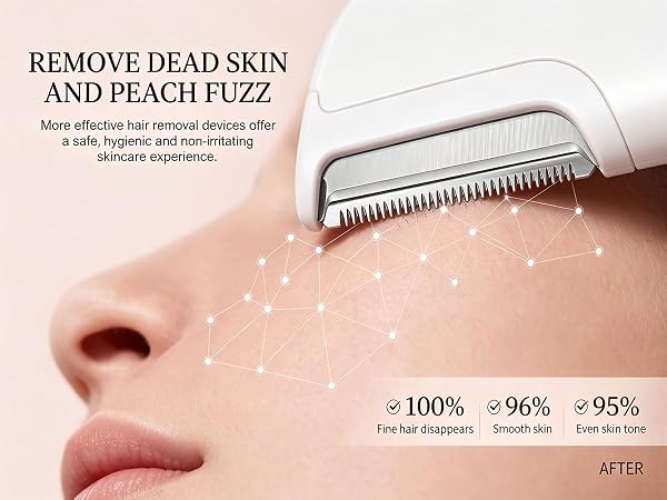 Remove dead ski and peach fuzz