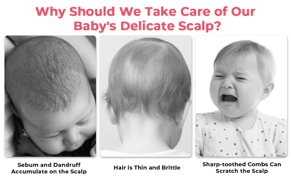 2Pcs Baby Hair Combs